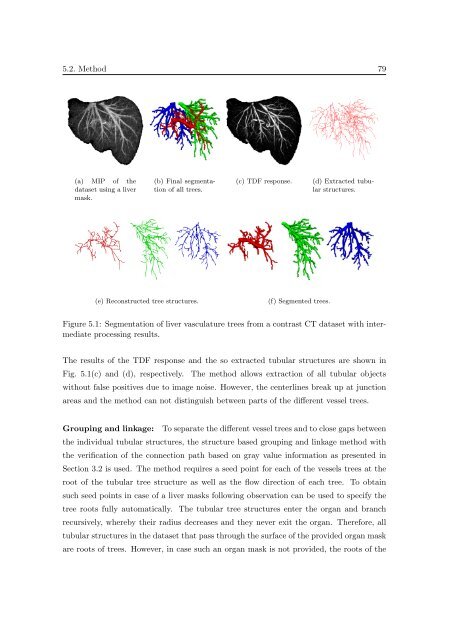 Segmentation of 3D Tubular Tree Structures in Medical Images ...