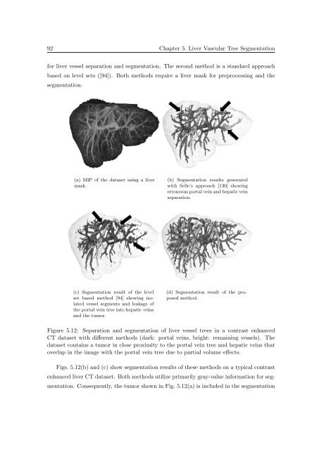 Segmentation of 3D Tubular Tree Structures in Medical Images ...