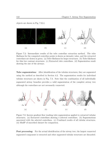 Segmentation of 3D Tubular Tree Structures in Medical Images ...