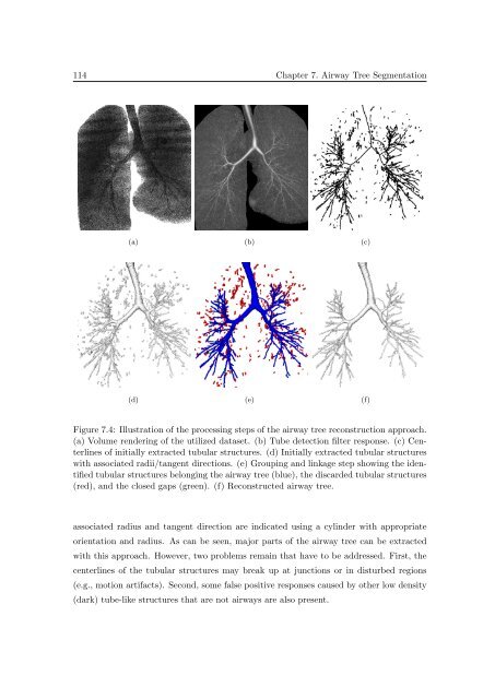 Segmentation of 3D Tubular Tree Structures in Medical Images ...