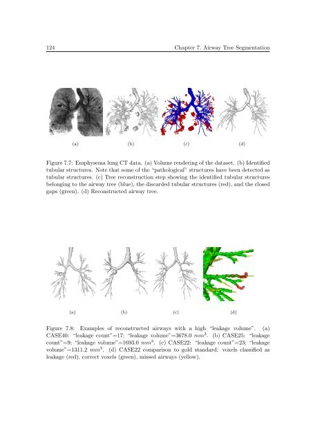 Segmentation of 3D Tubular Tree Structures in Medical Images ...