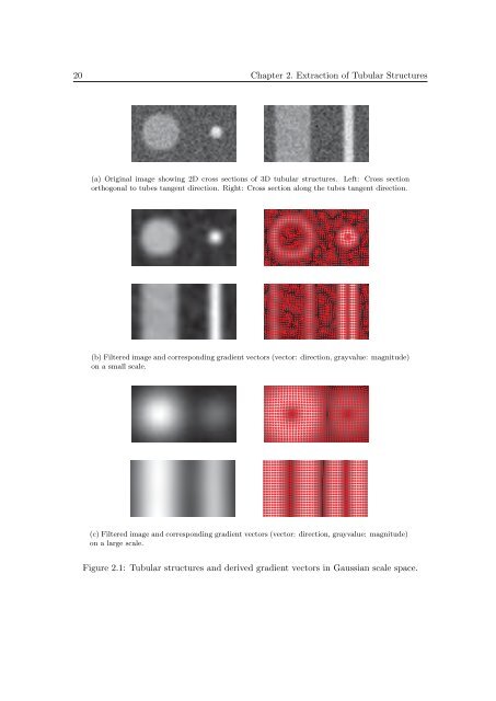 Segmentation of 3D Tubular Tree Structures in Medical Images ...