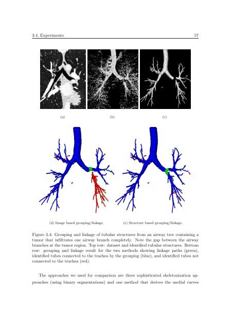 Segmentation of 3D Tubular Tree Structures in Medical Images ...