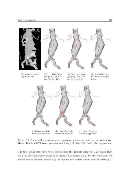 Segmentation of 3D Tubular Tree Structures in Medical Images ...