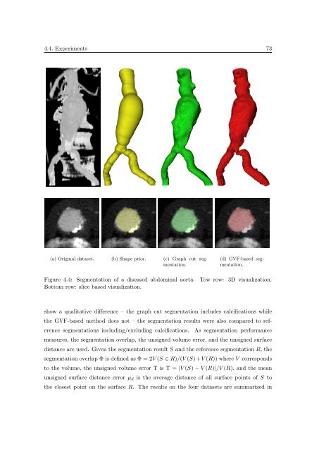 Segmentation of 3D Tubular Tree Structures in Medical Images ...