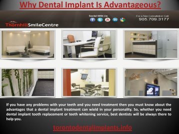  Why Dental Implant is Advantageous