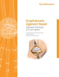 Scapholunate Ligament Repair - Smith & Nephew