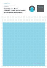 Tibiakop osteotomie - Catharina Ziekenhuis