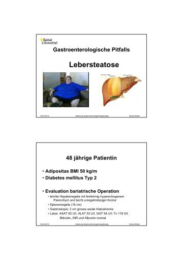 Dr. Daniel Boller: Gastroenterologische Pitfalls ... - Spital Limmattal