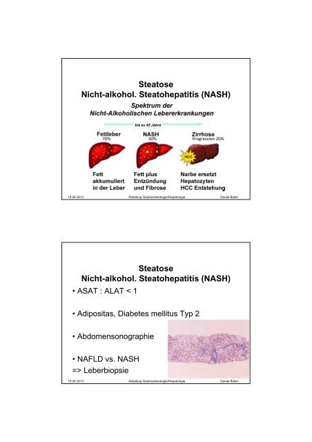 Dr. Daniel Boller: Gastroenterologische Pitfalls ... - Spital Limmattal