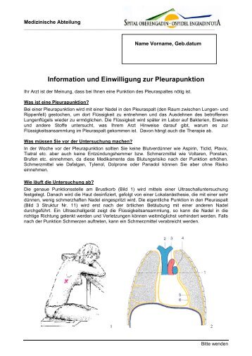 Information und Einwilligung zur Pleurapunktion - Spital Oberengadin