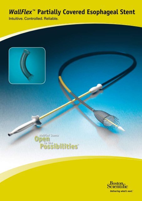 WallFlexâ ¢ Partially Covered Esophageal Stent - Boston Scientific