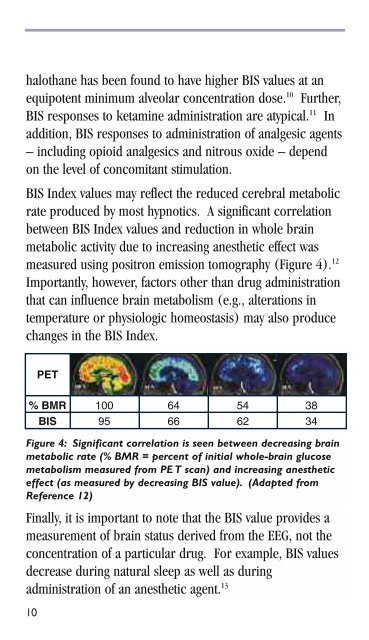 BIS guide for clinicians