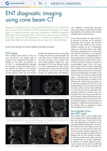 ENt diagnostic imaging using cone beam Ct - Soredex