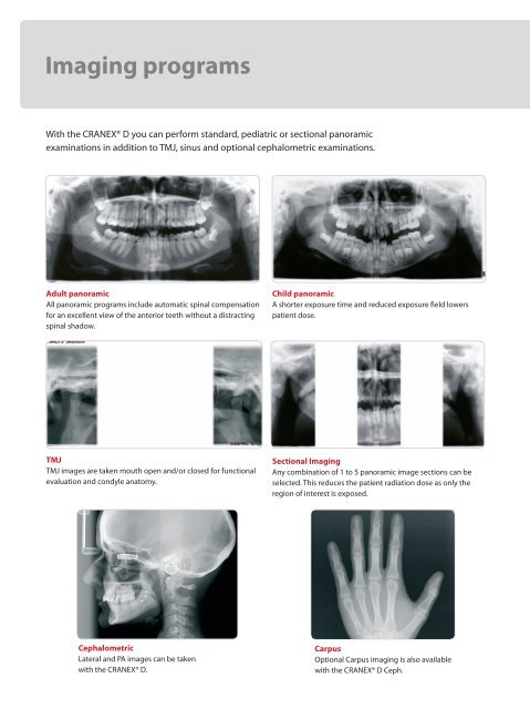 Brochure (pdf) - Soredex