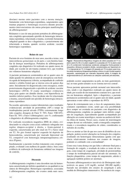 Acta Ped Vol 42 N 4 - Sociedade Portuguesa de Pediatria