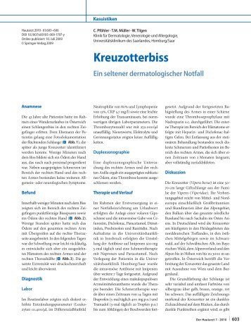 Kreuzotterbiss - Springer Medizin