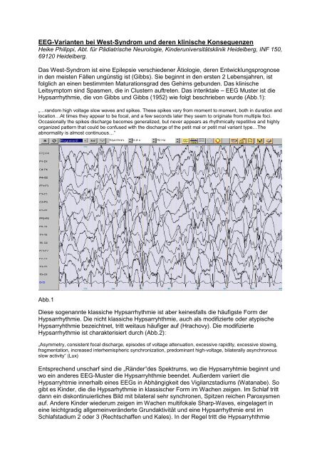 EEG-Varianten bei West-Syndrom und deren klinische Konsequenzen