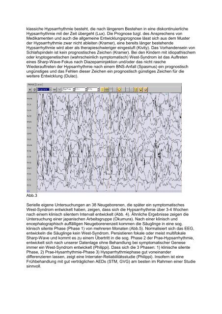 EEG-Varianten bei West-Syndrom und deren klinische Konsequenzen