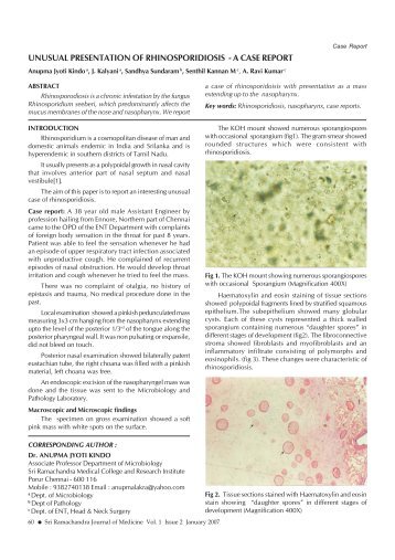 unusual presentation of rhinosporidiosis - Sri Ramachandra University