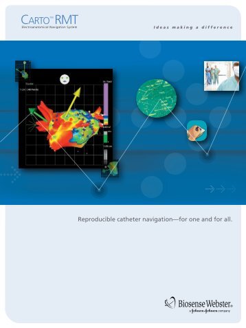 Carto™ RMT - Biosense Webster