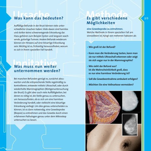 Erkrankungen der Brust (PDF) - St. Vincenz Krankenhaus Limburg