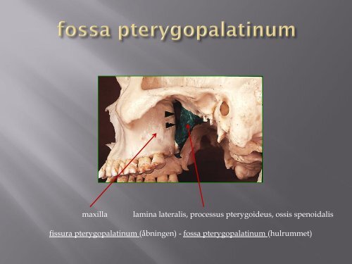 nervus trigeminus og fossa pterygopalatinum