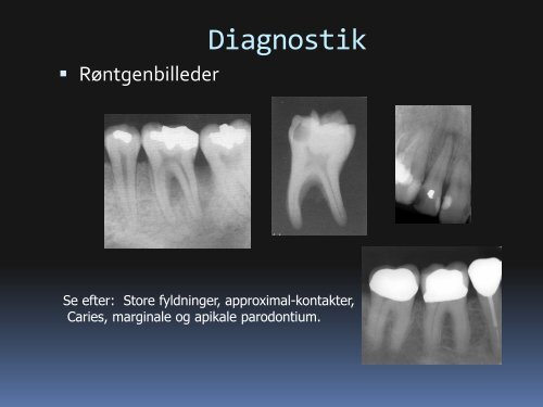 Behandling af akutte endodontiske tilstande