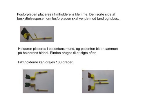 U4_Intraorale optagelser med parallelteknik og fosforplader ...