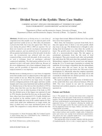 Divided Nevus of the Eyelids: Three Case Studies - In Vivo