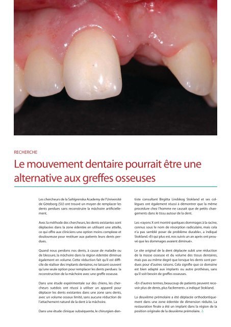 Blanchir les dents: une mode pas si anodine - dental suisse