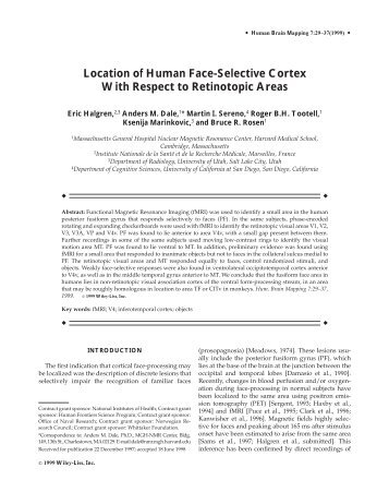 Location of human face-selective cortex with ... - Purdue University