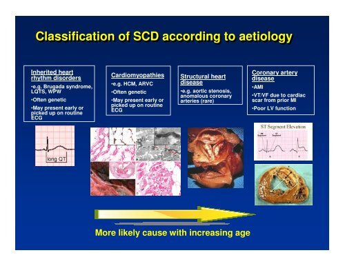 Introduction to Sudden Cardiac Death - National Heart Centre ...