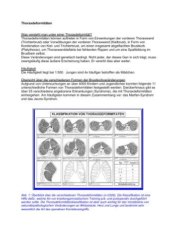 Angeborene Enddarmfehlbildungen (Analatresie)