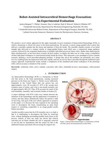 Robot-Assisted Intracerebral Hemorrhage Evacuation - Vanderbilt ...