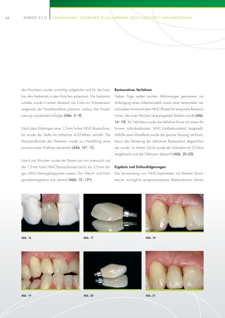 DIGITALE IMPLANTOLOGIE - Straumann Canada