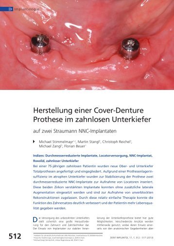 Herstellung einer Cover-Denture Prothese im zahnlosen Unterkiefer ...