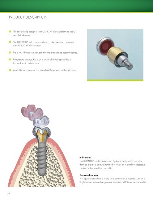 restoring straumann implants with locator® abutments