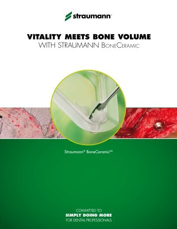 LIT262 Bone Ceramic Vitality Brochure - Straumann