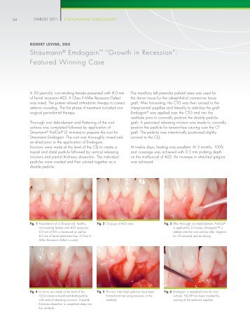 View a sample case - Straumann