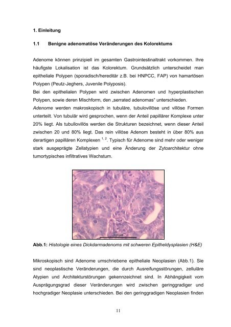 Hereditäre Tumorsyndrome des Kolons und Rektums