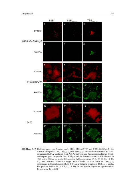 Regulationsmechanismen von Oxacillinresistenz und Biofilmbildung ...