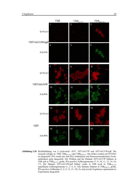 Regulationsmechanismen von Oxacillinresistenz und Biofilmbildung ...