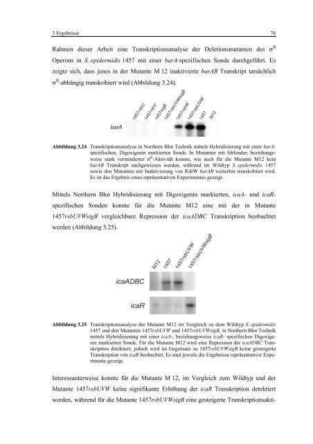 Regulationsmechanismen von Oxacillinresistenz und Biofilmbildung ...