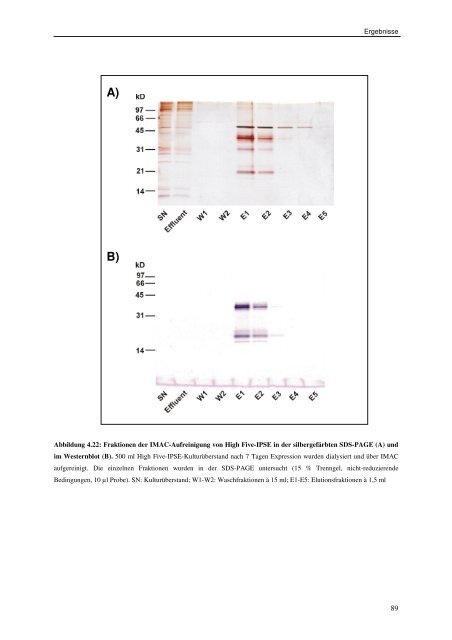 Rekombinante Expression des IL-4-induzierenden Schistosomen-Ei ...