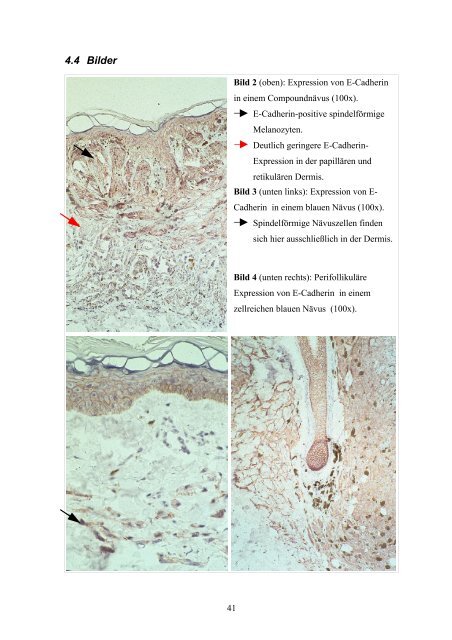 Dissertation F.Grotelüschen - Universität zu Lübeck