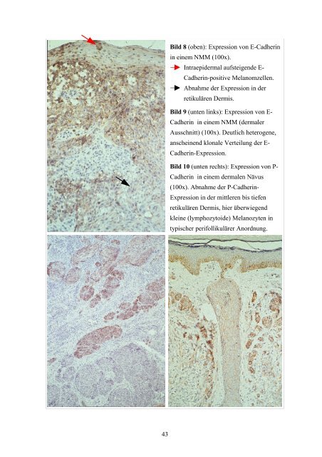 Dissertation F.Grotelüschen - Universität zu Lübeck