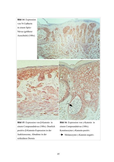 Dissertation F.Grotelüschen - Universität zu Lübeck