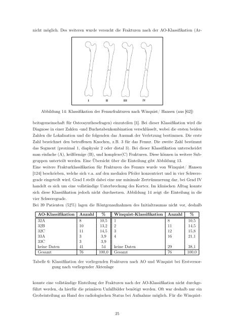 Der Druckplattenfixateur zur Pseudarthrosenbehandlung am Femur