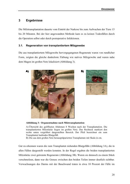 Bedeutung des Lymphotoxin-β-Rezeptors für die Bildung von ...